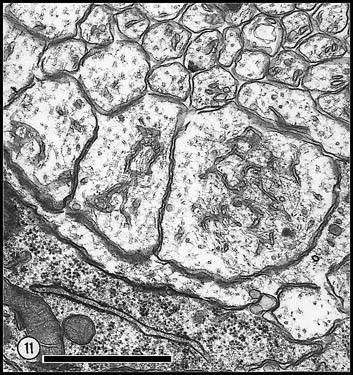 Glial cells