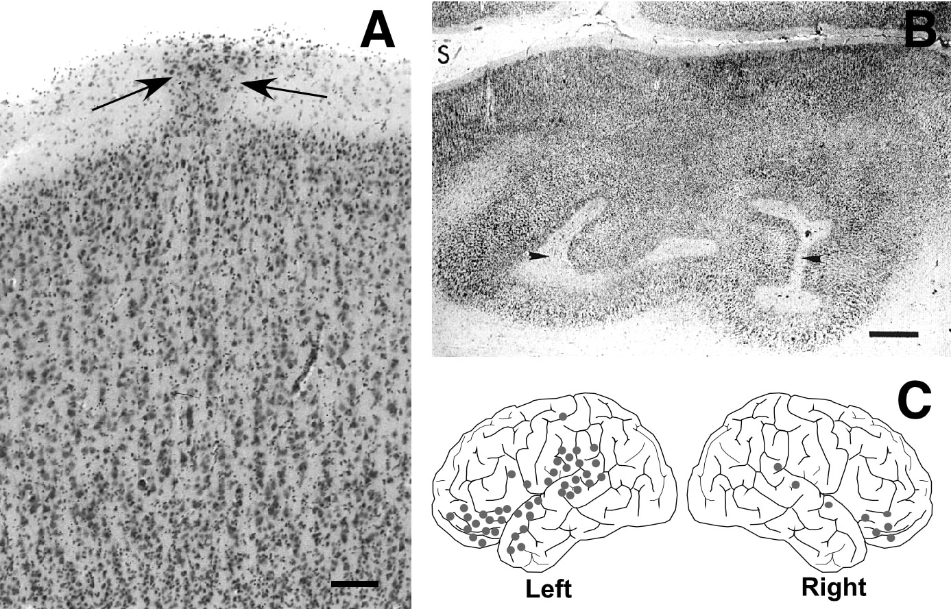 Animal Models of Dyslexia
