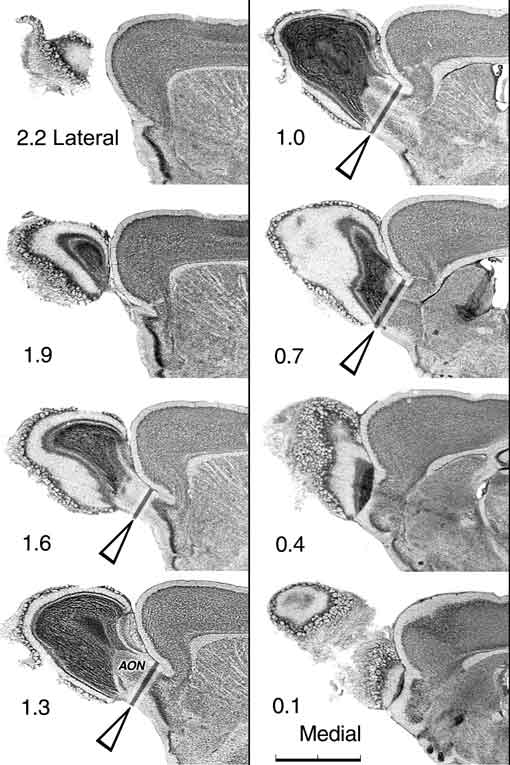 Figure 1: Olfactory bulb cut