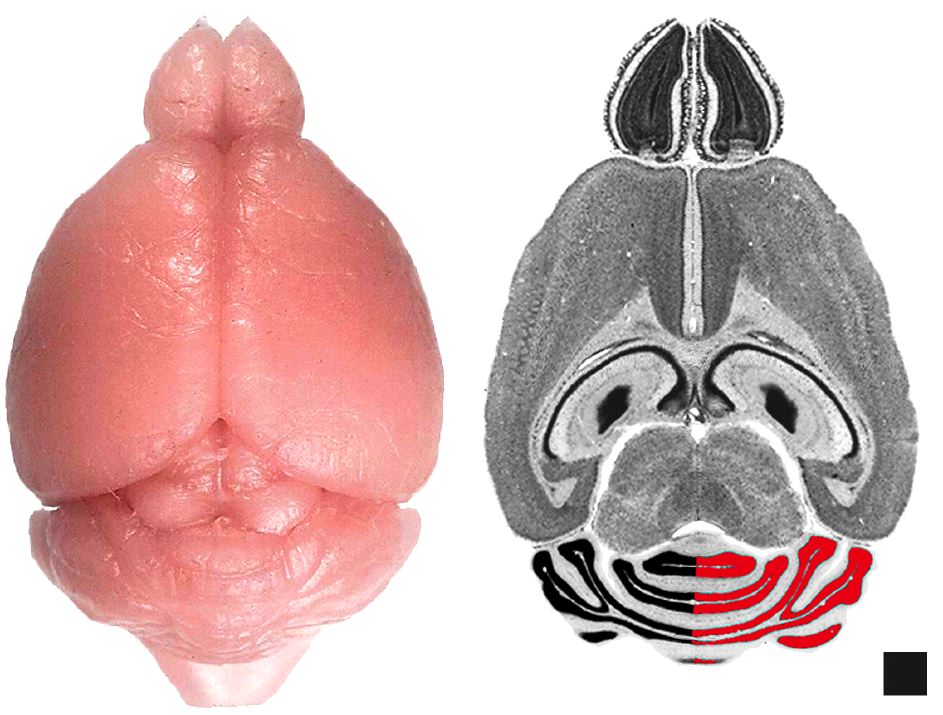 Figure 1: Methods of Analysis of Cerebellum
