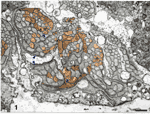 Figure 2 (micrograph)