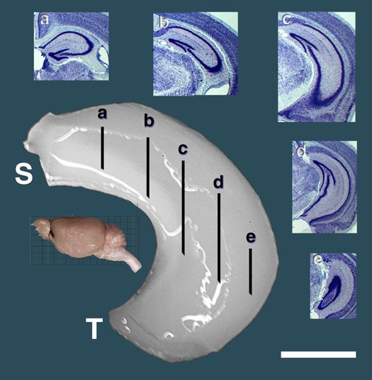 Figure 1: Dissection of the Mouse Hippocampus
